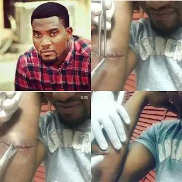 Popular Nollywood Actor Gets Stabbed By Over Excited Fan [PICS]